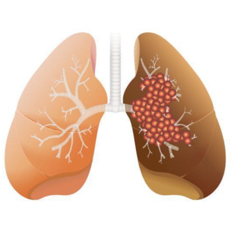 High dose of NMN inhibits the growth of lung adenocarcinoma
